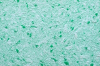 Жидкие обои Юрски Юкка 1206 Зеленый