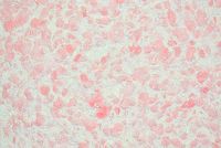 Рідкі шпалери Сілк Пластер RELEF 324R